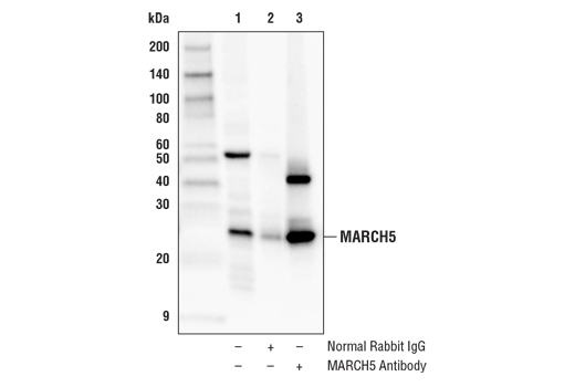 Immunoprecipitation Image 1: MARCH5 Antibody