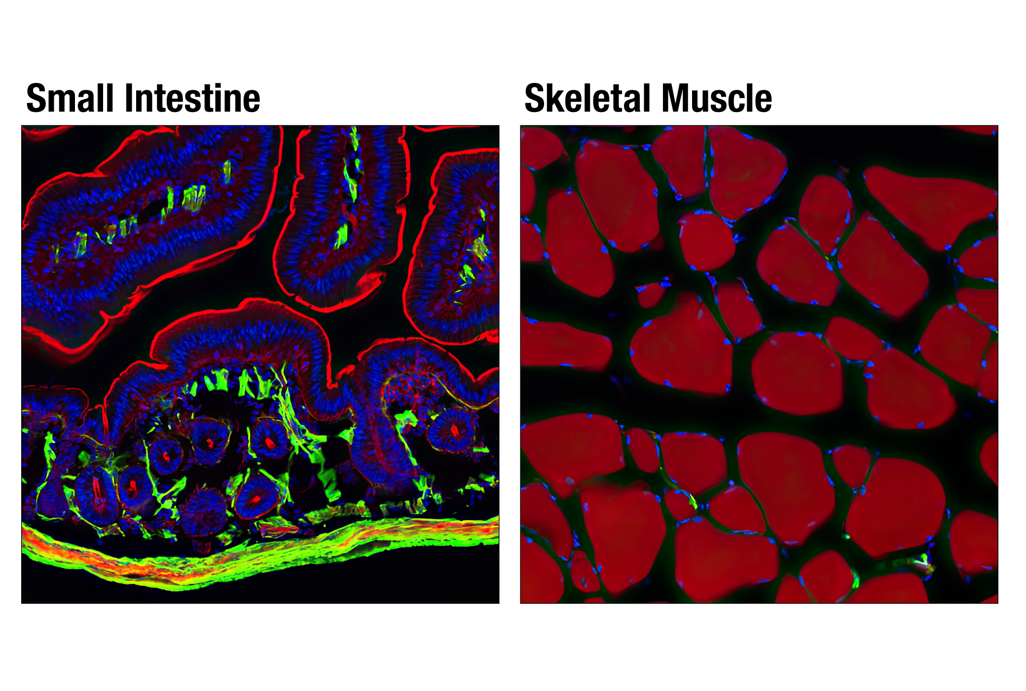 Immunofluorescence Image 1: α-Smooth Muscle Actin (D4K9N) XP® Rabbit mAb