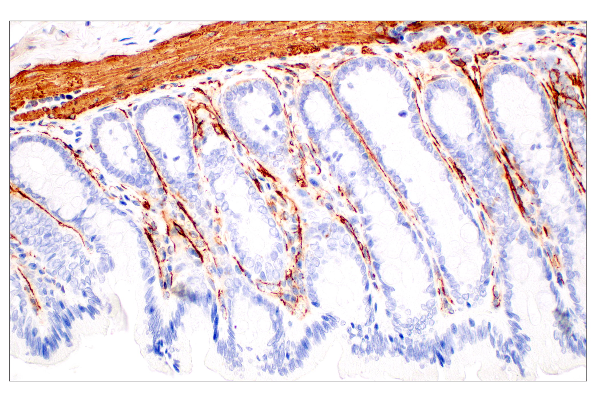  Image 56: Cancer Associated Fibroblast Marker Antibody Sampler Kit