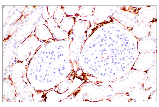 Immunohistochemistry Image 9: α-Smooth Muscle Actin (D4K9N) XP® Rabbit mAb
