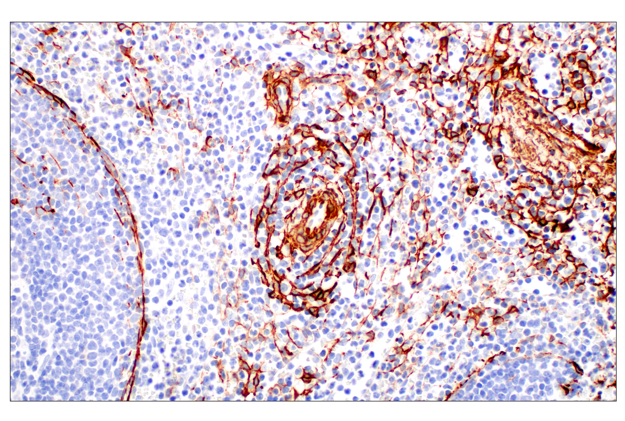 Immunohistochemistry Image 10: α-Smooth Muscle Actin (D4K9N) XP® Rabbit mAb