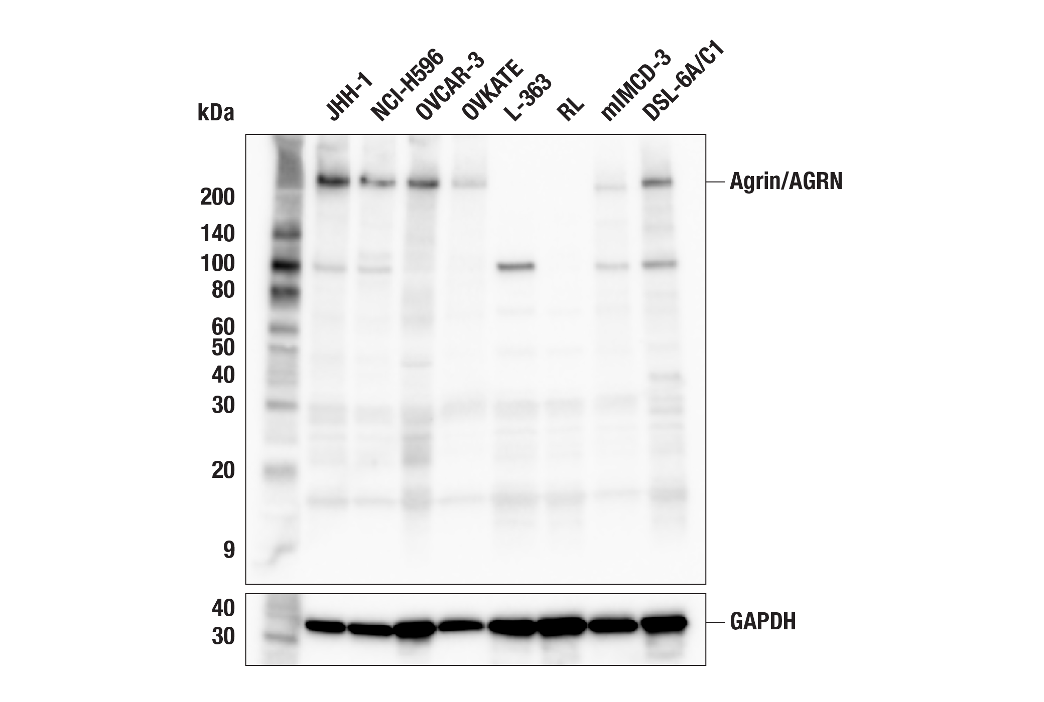 undefined Image 1: Agrin/AGRN (F1M3D) Rabbit Monoclonal Antibody