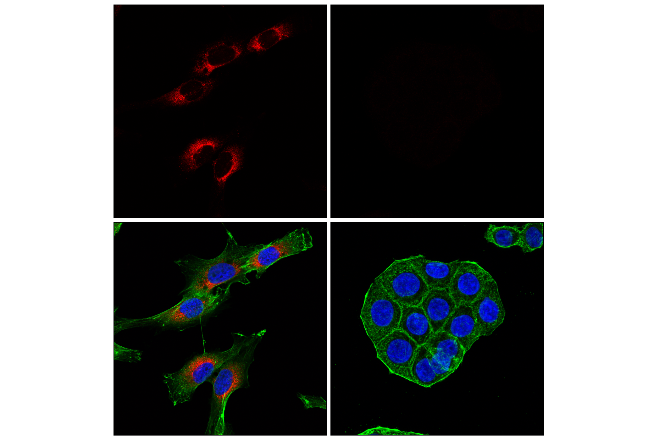 Immunofluorescence Image 3: COL1A1 (E8F4L) XP® Rabbit mAb (Alexa Fluor® 594 Conjugate)