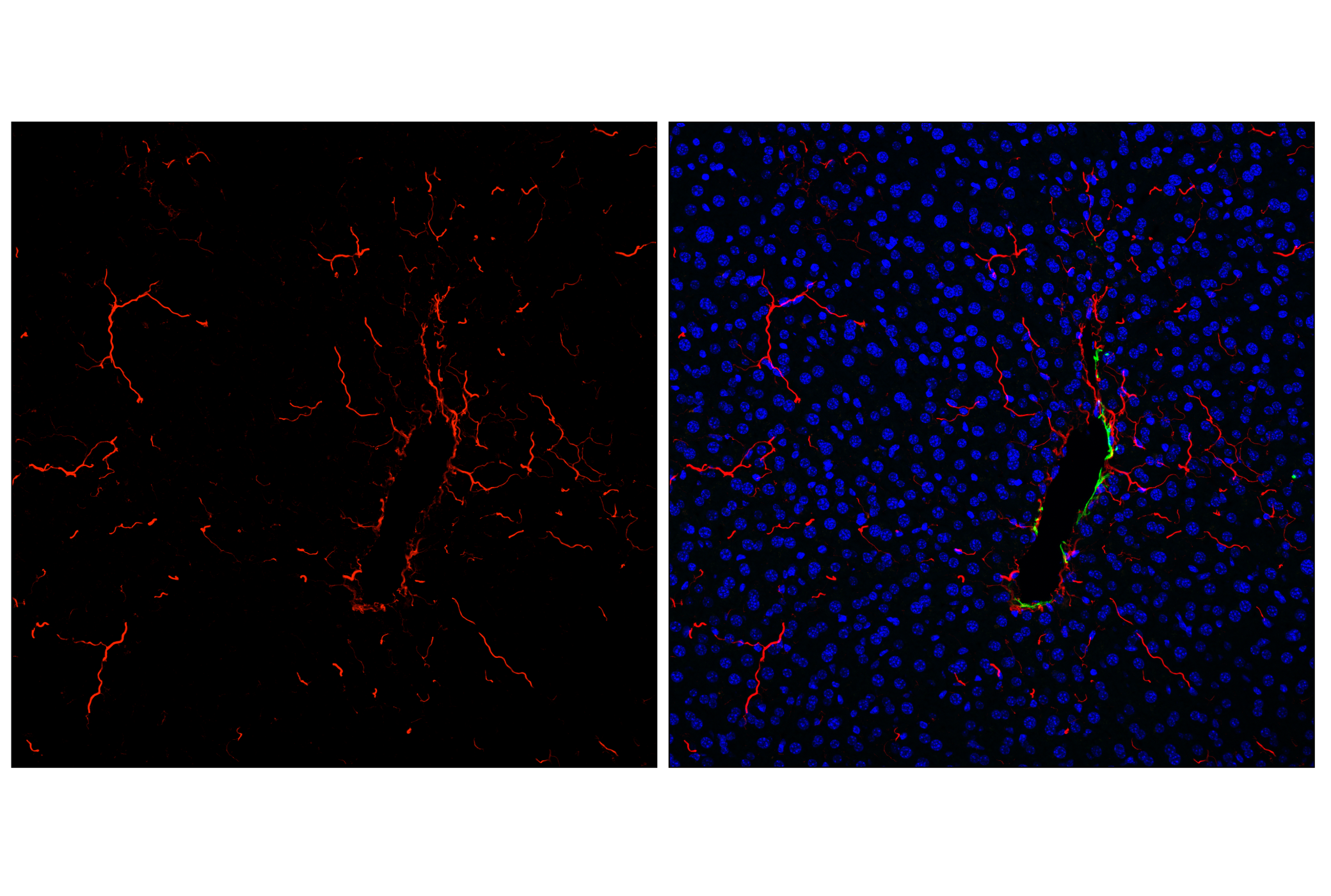 Immunofluorescence Image 2: COL1A1 (E8F4L) XP® Rabbit mAb (Alexa Fluor® 594 Conjugate)