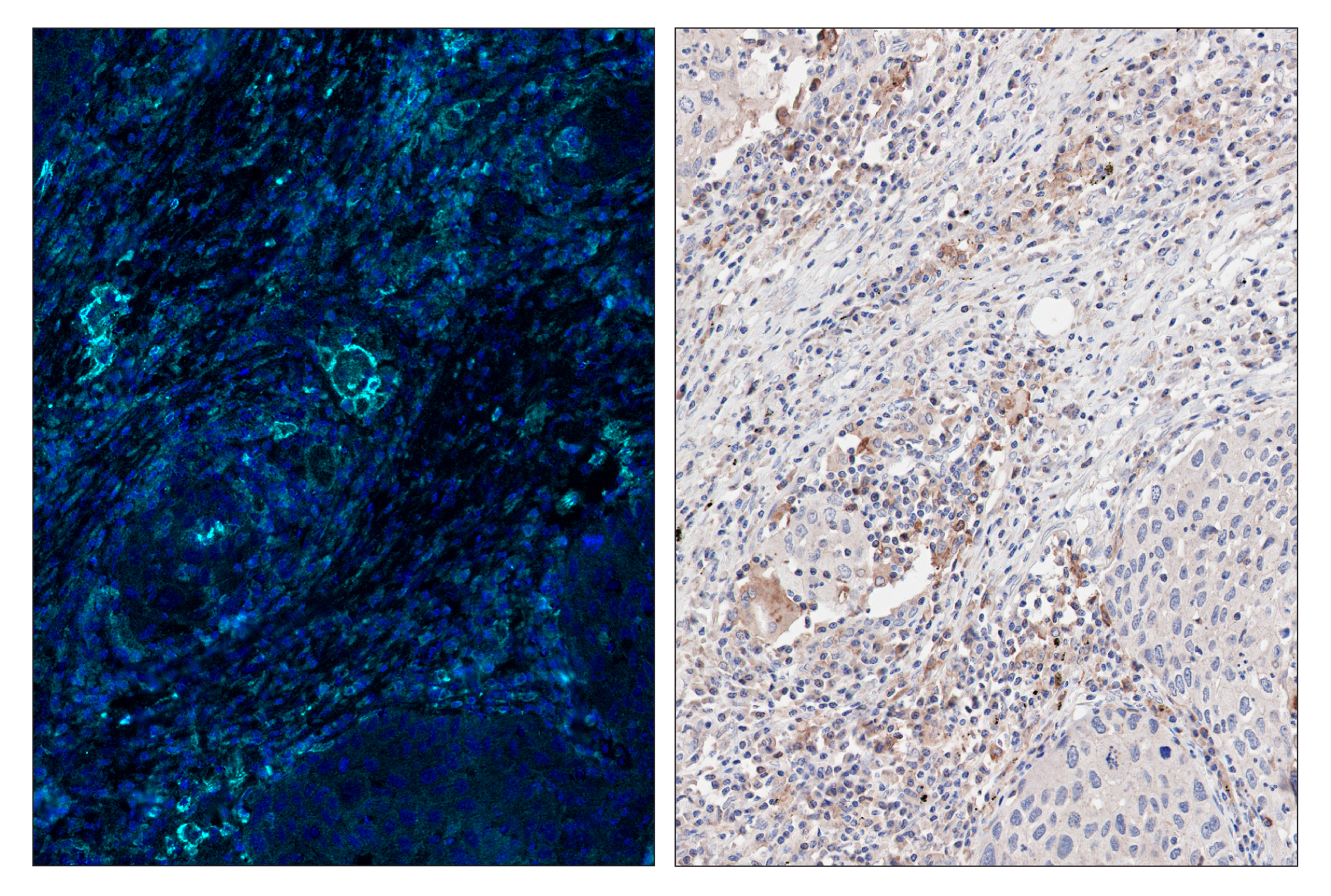 Immunohistochemistry Image 6: CD86 (E2G8P) & CO-0038-647 SignalStar™ Oligo-Antibody Pair