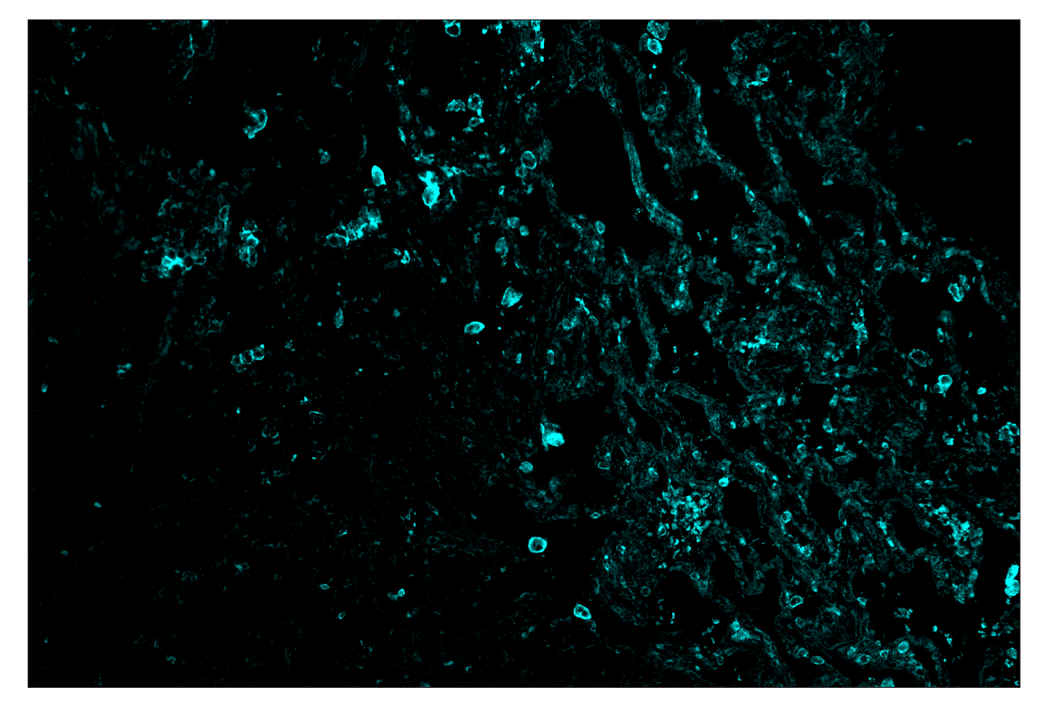 Immunohistochemistry Image 5: CD86 (E2G8P) & CO-0038-488 SignalStar™ Oligo-Antibody Pair