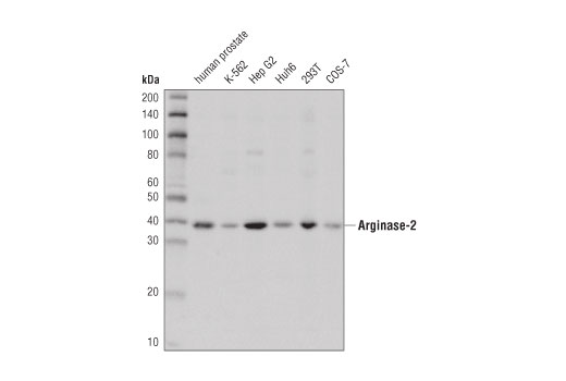 Western Blotting Image 1: Arginase-2 Antibody