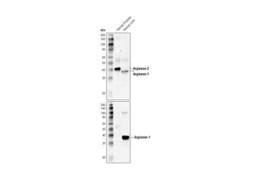Western Blotting Image 2: Arginase-2 Antibody