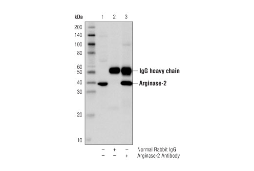 Immunoprecipitation Image 1: Arginase-2 Antibody