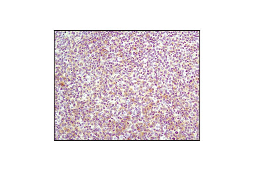 Immunohistochemistry Image 2: Lck (D88) XP® Rabbit mAb (BSA and Azide Free)