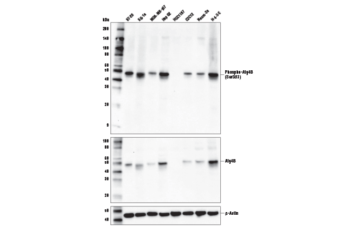 Western Blotting Image 2: Phospho-Atg4B (Ser383) Antibody