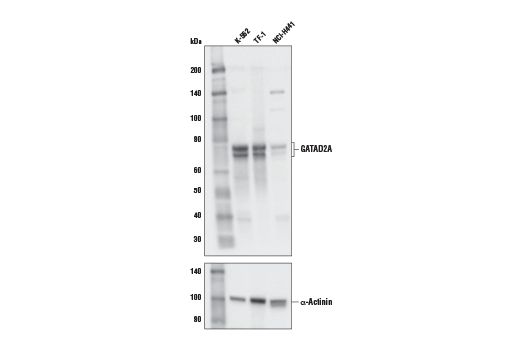 Western Blotting Image 1: GATAD2A Antibody