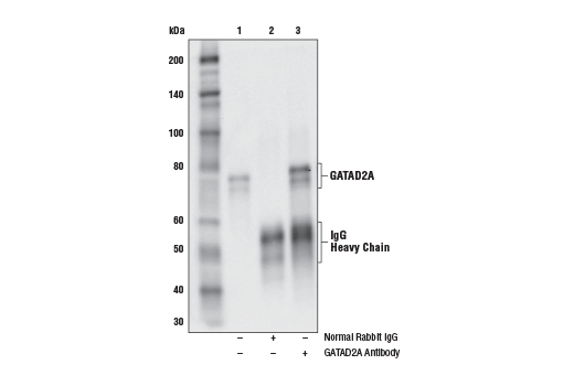 Immunoprecipitation Image 1: GATAD2A Antibody