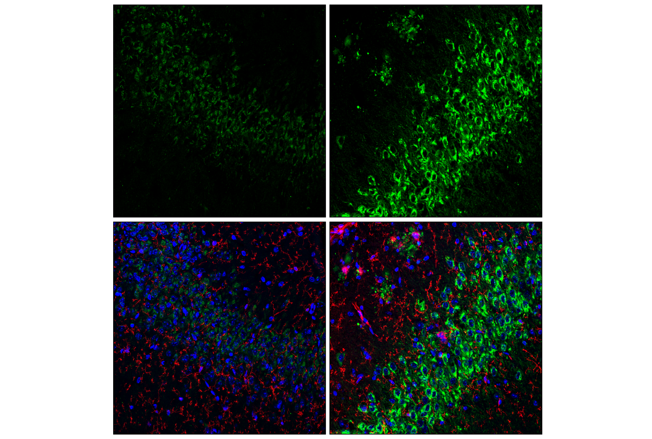 Immunofluorescence Image 1: APP (E3F3P) Rabbit mAb
