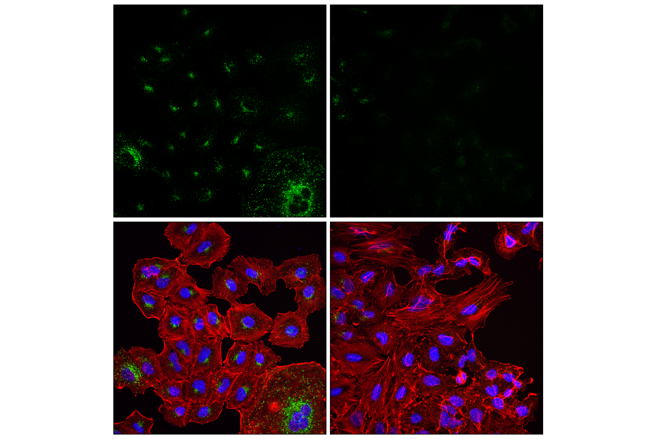 Immunofluorescence Image 3: APP (E3F3P) Rabbit mAb