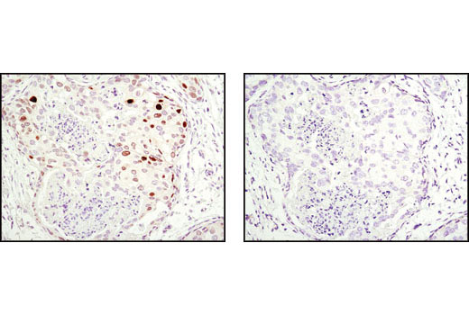 Immunohistochemistry Image 2: p21 Waf1/Cip1 (12D1) Rabbit mAb (BSA and Azide Free)