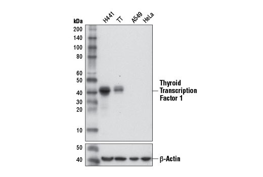 Western Blotting Image 1: Thyroid Transcription Factor 1 (TTF-1) (D2E8) Rabbit mAb (BSA and Azide Free)