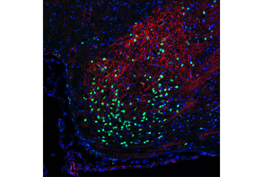 Immunofluorescence Image 1: Thyroid Transcription Factor 1 (TTF-1) (D2E8) Rabbit mAb (BSA and Azide Free)