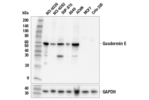  Image 1: Gasdermin Family Antibody Sampler Kit