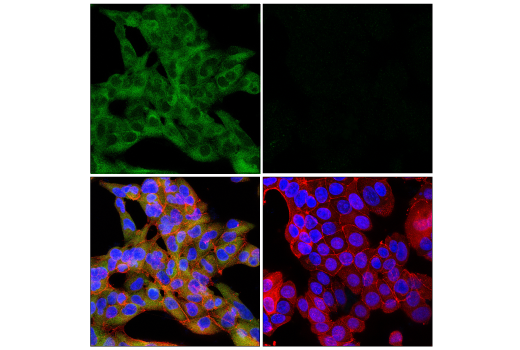Immunofluorescence Image 1: Gasdermin E (E2X7E) Rabbit mAb
