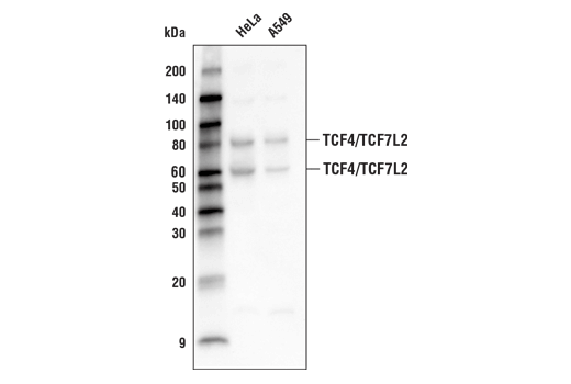 Western Blotting Image 1: TCF4/TCF7L2 (C48H11) Rabbit mAb (Biotinylated)