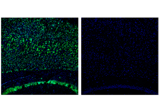 Immunofluorescence Image 1: Cas9 (S. pyogenes) (E7M1H) XP® Rabbit mAb (BSA and Azide Free)