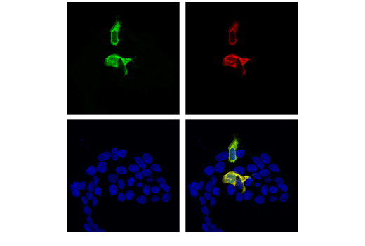 Immunofluorescence Image 1: Cas9 (S. pyogenes) (E7M1H) XP® Rabbit mAb (BSA and Azide Free)
