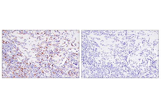 Immunohistochemistry Image 4: 4-1BB/CD137/TNFRSF9 (E6Z7F) XP® Rabbit mAb