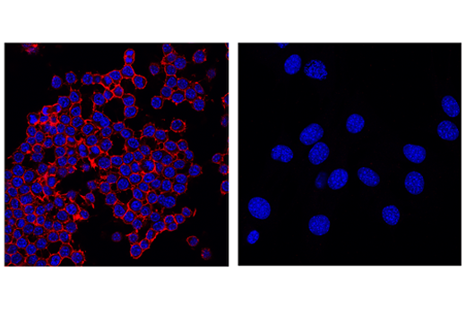 Immunofluorescence Image 2: CD45 (D3F8Q) Rabbit mAb (Alexa Fluor® 555 Conjugate)