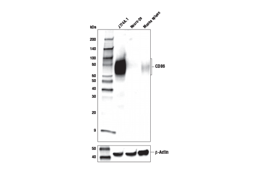  Image 6: Mouse Reactive M1 vs M2 Macrophage IHC Antibody Sampler Kit