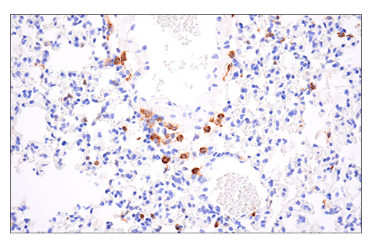  Image 23: Mouse Reactive M1 vs M2 Macrophage IHC Antibody Sampler Kit