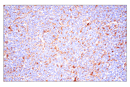  Image 28: Mouse Reactive M1 vs M2 Macrophage IHC Antibody Sampler Kit