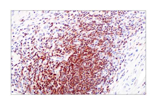 Immunohistochemistry Image 5: PI3 Kinase p110 δ (E2T2N) Rabbit mAb