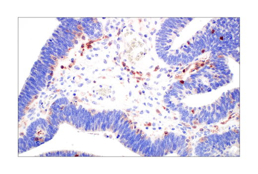 Immunohistochemistry Image 8: PI3 Kinase p110 δ (E2T2N) Rabbit mAb