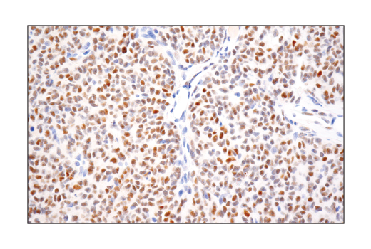 Immunohistochemistry Image 1: PRAME (E7I1B) Rabbit mAb (BSA and Azide Free)
