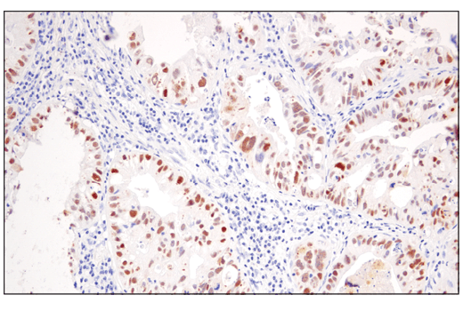 Immunohistochemistry Image 3: PRAME (E7I1B) Rabbit mAb (BSA and Azide Free)