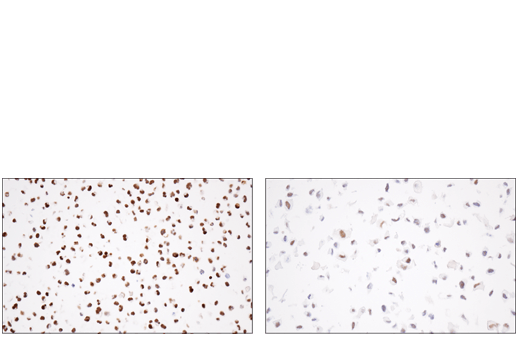 Immunohistochemistry Image 5: PRAME (E7I1B) Rabbit mAb (BSA and Azide Free)