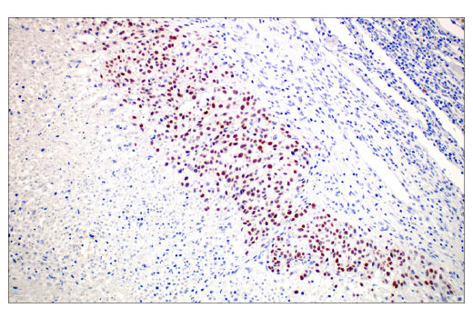 Immunohistochemistry Image 7: PRAME (E7I1B) Rabbit mAb (BSA and Azide Free)