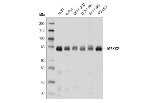 Western Blotting Image 2: MEKK2 Antibody