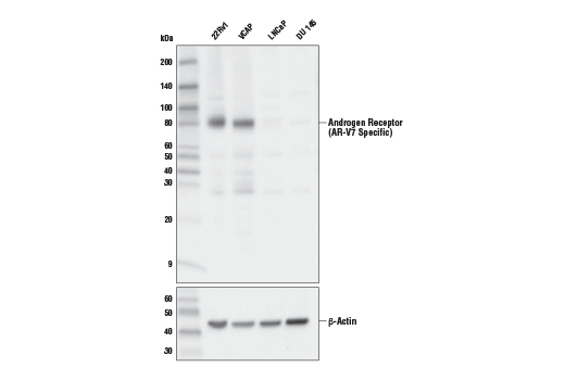 Western Blotting Image 1: Androgen Receptor (AR-V7 Specific) (E3O8L) Rabbit mAb