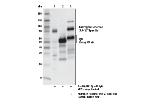 Immunoprecipitation Image 1: Androgen Receptor (AR-V7 Specific) (E3O8L) Rabbit mAb