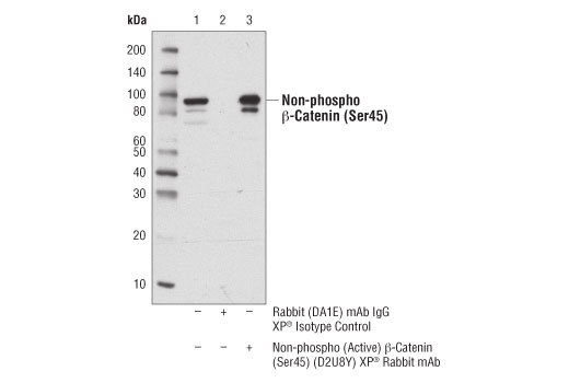 Immunoprecipitation Image 1: Non-phospho (Active) β-Catenin (Ser45) (D2U8Y) XP® Rabbit mAb