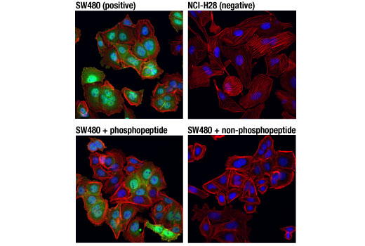 Immunofluorescence Image 2: Non-phospho (Active) β-Catenin (Ser45) (D2U8Y) XP® Rabbit mAb
