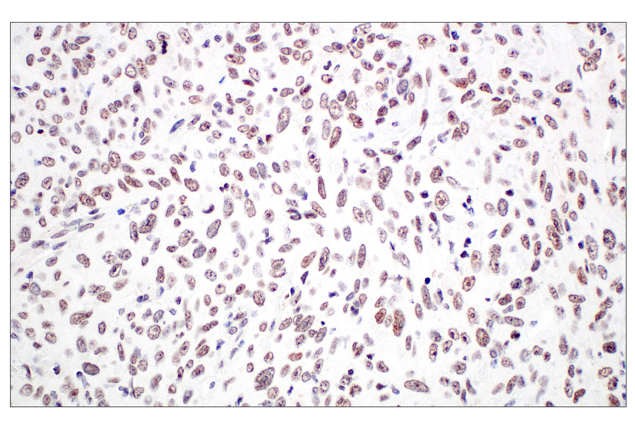 Immunohistochemistry Image 3: Menin (E5P1R) Rabbit mAb