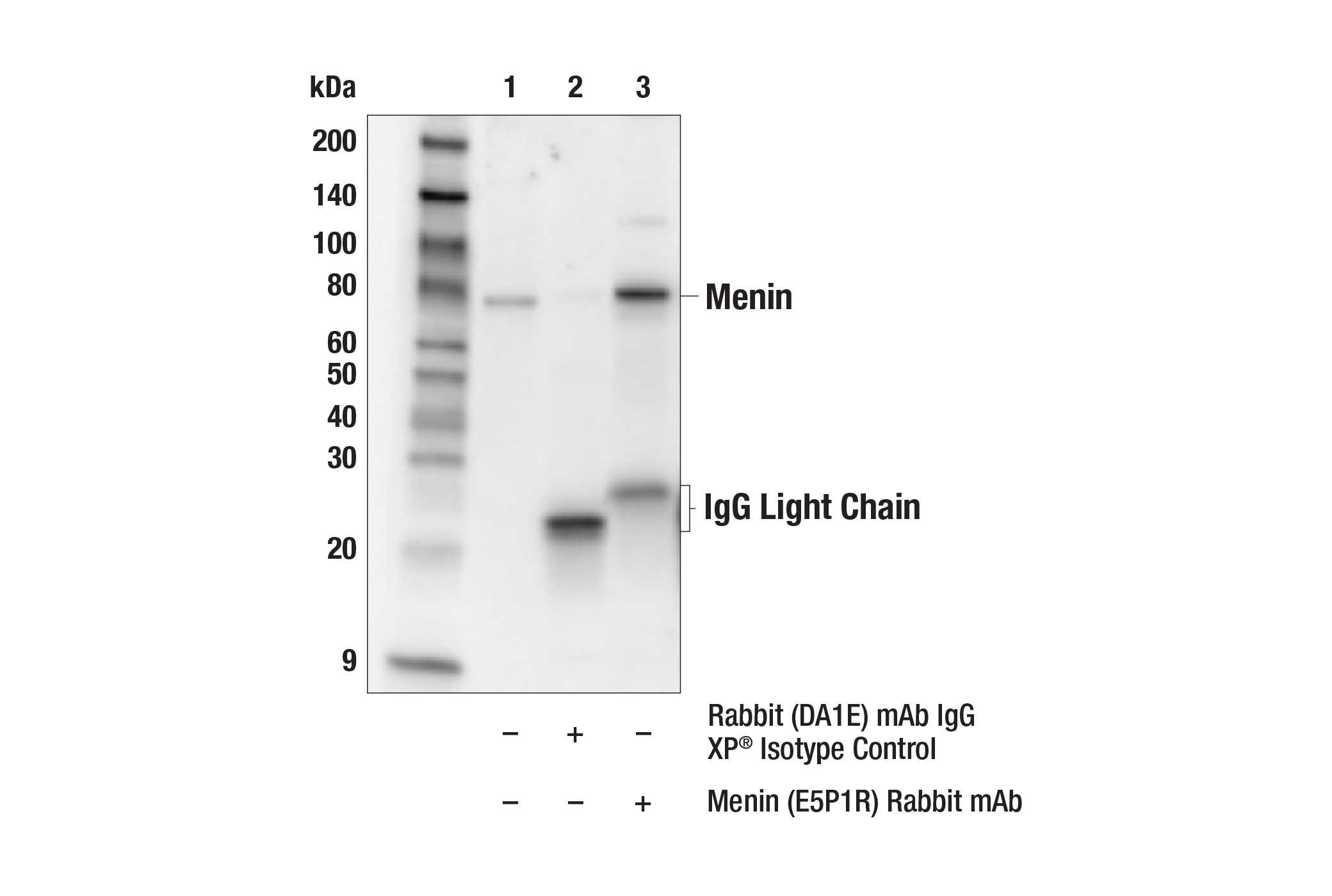 Immunoprecipitation Image 1: Menin (E5P1R) Rabbit mAb
