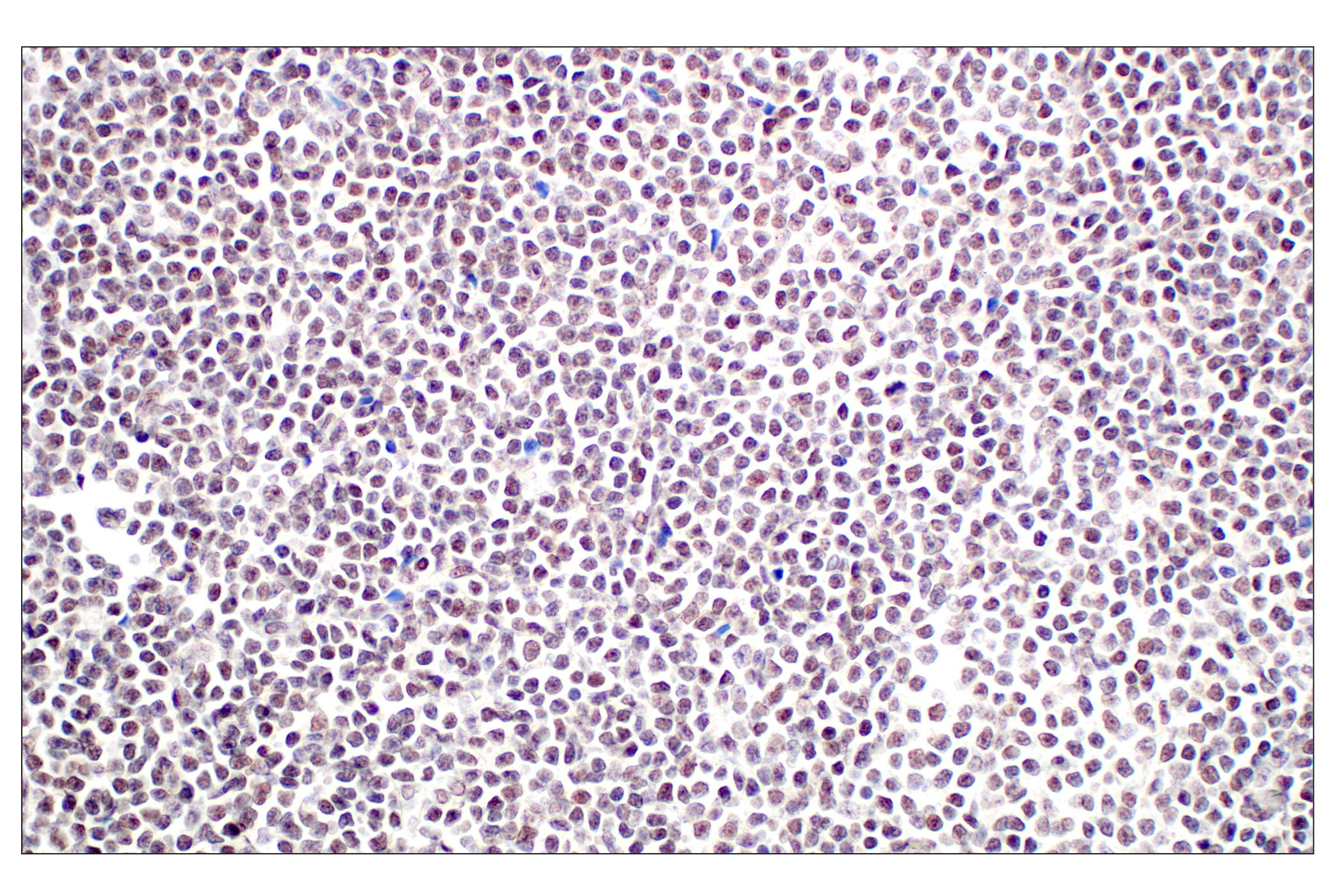 Immunohistochemistry Image 2: Menin (E5P1R) Rabbit mAb