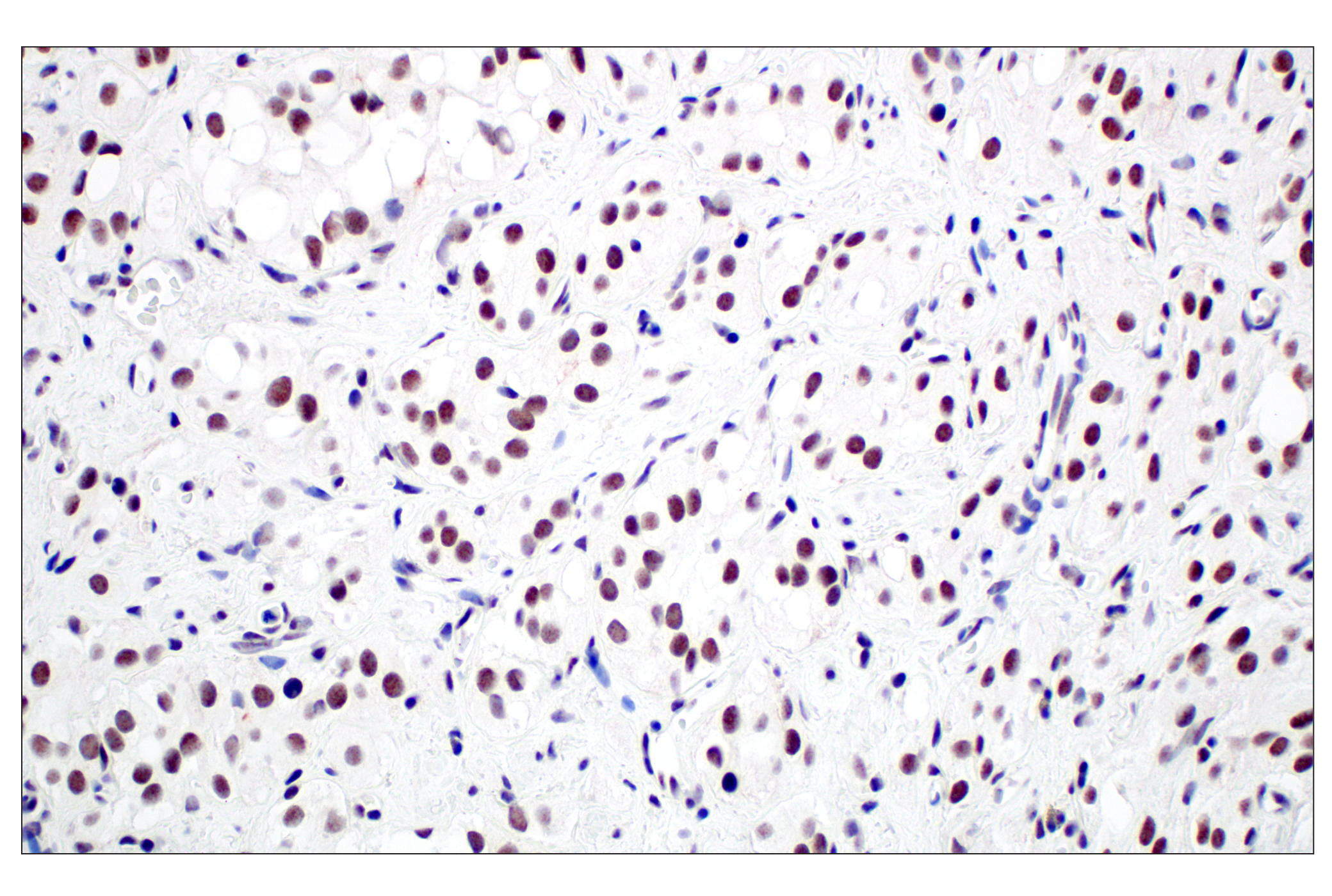 Immunohistochemistry Image 5: Menin (E5P1R) Rabbit mAb