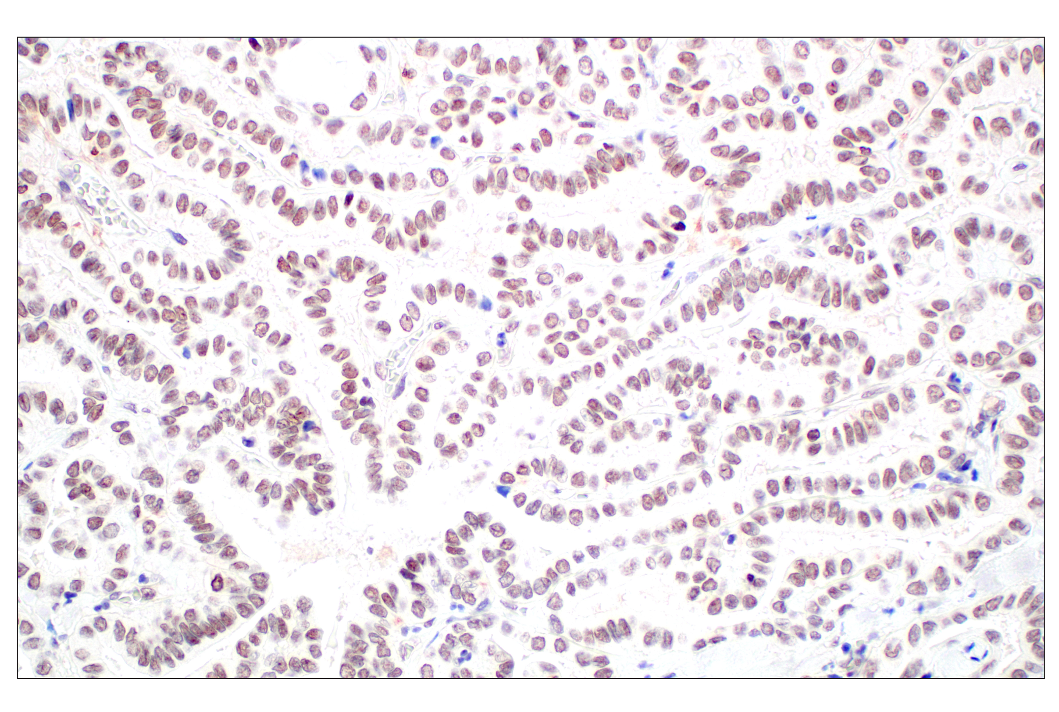 Immunohistochemistry Image 4: Menin (E5P1R) Rabbit mAb