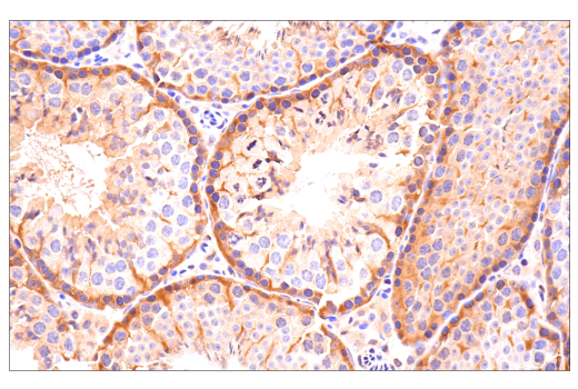 Immunohistochemistry Image 13: YAP/TAZ (E9M8G) Rabbit mAb (BSA and Azide Free)