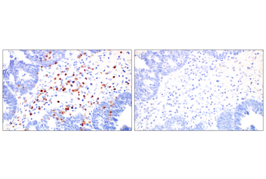 Immunohistochemistry Image 4: CD2 (D6V9F) Rabbit mAb (BSA and Azide Free)